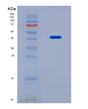 SDS-PAGE analysis of Human NR4A2 (Nuclear Receptor Subfamily 4 Group A Member 2) - Recombinant Protein, CAT# BLT-08699P showing >90% purity under 15% SDS-PAGE (Reduced)