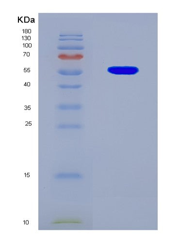 SDS-PAGE analysis of Human TP53 (Cellular Tumor Antigen P53) - Recombinant Protein, CAT# BLT-08701P showing >90% purity under 15% SDS-PAGE (Reduced)