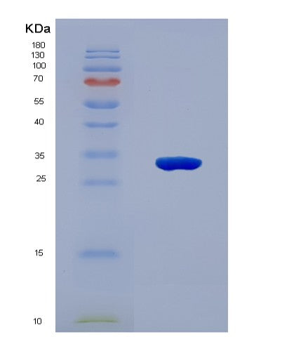 SDS-PAGE analysis of Mouse Tp53 (Cellular Tumor Antigen P53) - Recombinant Protein, CAT# BLT-08702P showing >90% purity under 15% SDS-PAGE (Reduced)