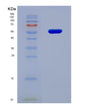 SDS-PAGE analysis of Human CYP17A1 (Steroid 17-Alpha-Hydroxylase/17,20 Lyase) - Recombinant Protein, CAT# BLT-08703P showing >90% purity under 15% SDS-PAGE (Reduced)