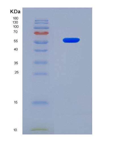SDS-PAGE analysis of Human CYP7A1 (Cytochrome P450 7A1) - Recombinant Protein, CAT# BLT-08704P showing >90% purity under 15% SDS-PAGE (Reduced)