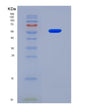 SDS-PAGE analysis of Human CYP7A1 (Cytochrome P450 7A1) - Recombinant Protein, CAT# BLT-08704P showing >90% purity under 15% SDS-PAGE (Reduced)