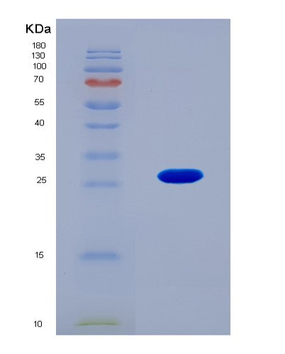 SDS-PAGE analysis of Mouse (Protein Il-40) - Recombinant Protein, CAT# BLT-08705P showing >90% purity under 15% SDS-PAGE (Reduced)