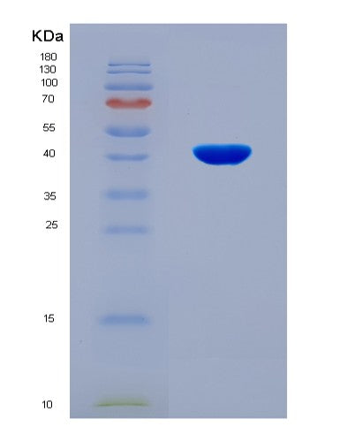 SDS-PAGE analysis of Human PRKACA (Camp-Dependent Protein Kinase Catalytic Subunit Alpha) - Recombinant Protein, CAT# BLT-08706P showing >90% purity under 15% SDS-PAGE (Reduced)