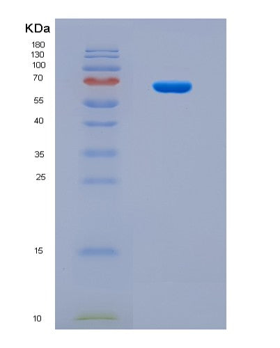 SDS-PAGE analysis of Human CYP19A1 (Aromatase) - Recombinant Protein, CAT# BLT-08708P showing >90% purity under 15% SDS-PAGE (Reduced)