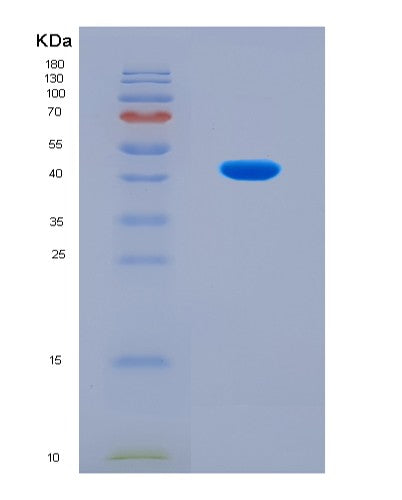 SDS-PAGE analysis of Human ACAT1 (Acetyl-Coa Acetyltransferase, Mitochondrial) - Recombinant Protein, CAT# BLT-08710P showing >90% purity under 15% SDS-PAGE (Reduced)