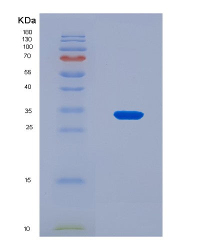 SDS-PAGE analysis of Human FCGRT (Igg Receptor Fcrn Large Subunit P51) - Recombinant Protein, CAT# BLT-08713P showing >90% purity under 15% SDS-PAGE (Reduced)