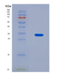 SDS-PAGE analysis of Human FCGRT (Igg Receptor Fcrn Large Subunit P51) - Recombinant Protein, CAT# BLT-08713P showing >90% purity under 15% SDS-PAGE (Reduced)