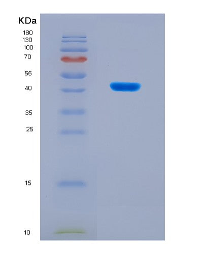 SDS-PAGE analysis of Mouse arginine N-methyltransferase 1 (Prmt1) - Recombinant Protein, CAT# BLT-08714P showing >90% purity under 15% SDS-PAGE (Reduced)
