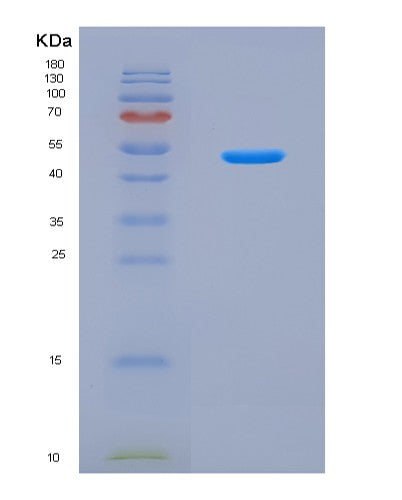 SDS-PAGE analysis of Mouse Aass (Alpha-Aminoadipic Semialdehyde Synthase, Mitochondrial) - Recombinant Protein, CAT# BLT-08715P showing >90% purity under 15% SDS-PAGE (Reduced)
