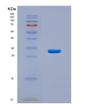SDS-PAGE analysis of Human TOP2A (Dna Topoisomerase 2-Alpha) - Recombinant Protein, CAT# BLT-08722P showing >90% purity under 15% SDS-PAGE (Reduced)