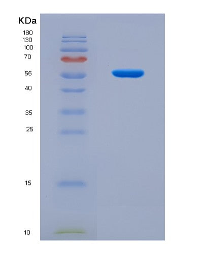 SDS-PAGE analysis of Human CRTC2 (Creb-Regulated Transcription Coactivator 2) - Recombinant Protein, CAT# BLT-08724P showing >90% purity under 15% SDS-PAGE (Reduced)