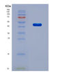 SDS-PAGE analysis of Human MAPK1 (Mitogen-Activated Protein Kinase 1) - Recombinant Protein, CAT# BLT-08726P showing >90% purity under 15% SDS-PAGE (Reduced)