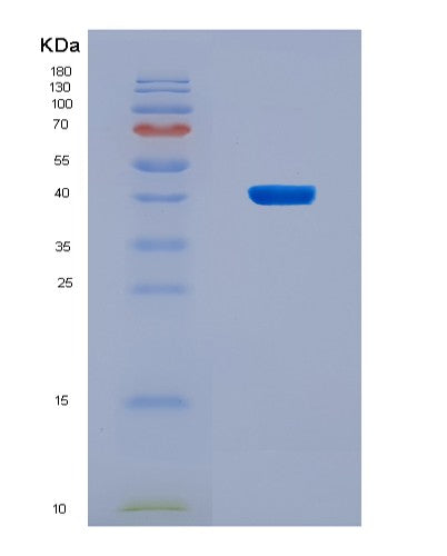 SDS-PAGE analysis of Human WNT6 (Protein Wnt-6) - Recombinant Protein, CAT# BLT-08727P showing >90% purity under 15% SDS-PAGE (Reduced)