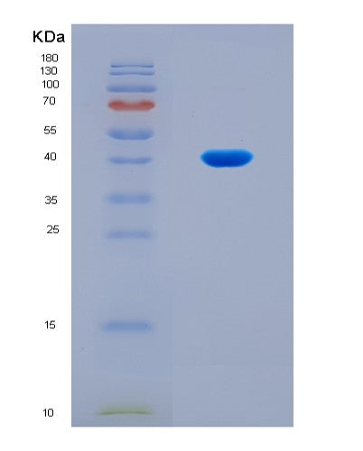 SDS-PAGE analysis of Human C5 (Complement C5) - Recombinant Protein, CAT# BLT-08732P showing >90% purity under 15% SDS-PAGE (Reduced)