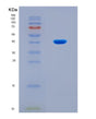 SDS-PAGE analysis of Human C5 (Complement C5) - Recombinant Protein, CAT# BLT-08732P showing >90% purity under 15% SDS-PAGE (Reduced)