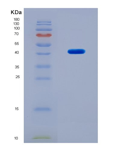 SDS-PAGE analysis of Human C7 (Complement Component C7) - Recombinant Protein, CAT# BLT-08734P showing >90% purity under 15% SDS-PAGE (Reduced)