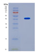 SDS-PAGE analysis of Human C7 (Complement Component C7) - Recombinant Protein, CAT# BLT-08734P showing >90% purity under 15% SDS-PAGE (Reduced)