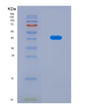 SDS-PAGE analysis of Human C8B (Complement Component C8 Beta Chain) - Recombinant Protein, CAT# BLT-08735P showing >90% purity under 15% SDS-PAGE (Reduced)