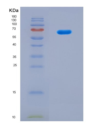 SDS-PAGE analysis of Human EPHX1 (Epoxide Hydrolase 1) - Recombinant Protein, CAT# BLT-08737P showing >90% purity under 15% SDS-PAGE (Reduced)