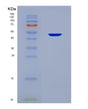 SDS-PAGE analysis of Human KRT17 (Keratin, Type I Cytoskeletal 17) - Recombinant Protein, CAT# BLT-08741P showing >90% purity under 15% SDS-PAGE (Reduced)