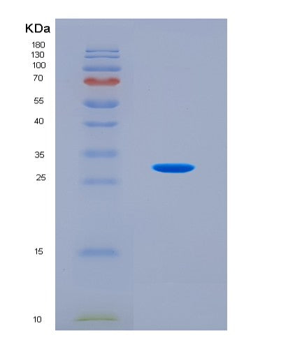 SDS-PAGE analysis of Mouse Gls (Glutaminase Kidney Isoform, Mitochondrial) - Recombinant Protein, CAT# BLT-08742P showing >90% purity under 15% SDS-PAGE (Reduced)