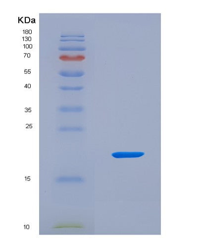 SDS-PAGE analysis of Human RPS23 (Small Ribosomal Subunit Protein Us12) - Recombinant Protein, CAT# BLT-08743P showing >90% purity under 15% SDS-PAGE (Reduced)