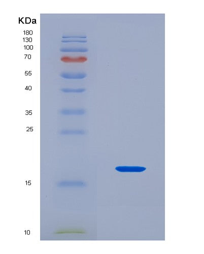 SDS-PAGE analysis of Human FAU (Ubiquitin-Like Fubi-Ribosomal Protein Es30 Fusion Protein) - Recombinant Protein, CAT# BLT-08744P showing >90% purity under 15% SDS-PAGE (Reduced)