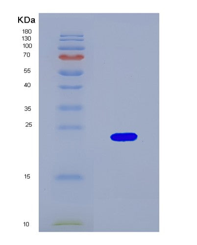 SDS-PAGE analysis of Human D2HGDH (D-2-Hydroxyglutarate Dehydrogenase, Mitochondrial) - Recombinant Protein, CAT# BLT-08745P showing >90% purity under 15% SDS-PAGE (Reduced)