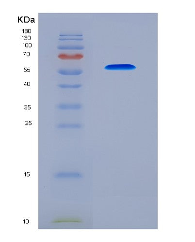 SDS-PAGE analysis of Human FSHR (Follicle-Stimulating Hormone Receptor) - Recombinant Protein, CAT# BLT-08619P showing >90% purity under 15% SDS-PAGE (Reduced)