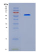 SDS-PAGE analysis of Human FSHR (Follicle-Stimulating Hormone Receptor) - Recombinant Protein, CAT# BLT-08619P showing >90% purity under 15% SDS-PAGE (Reduced)