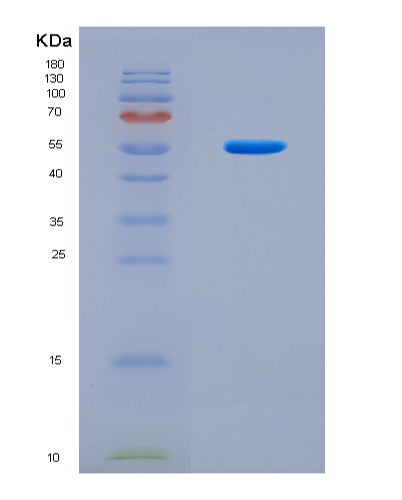 SDS-PAGE analysis of Human TNFSF11 (Tumor Necrosis Factor Ligand Superfamily Member 11) - Recombinant Protein, CAT# BLT-08751P showing >85% purity under 15% SDS-PAGE (Reduced)