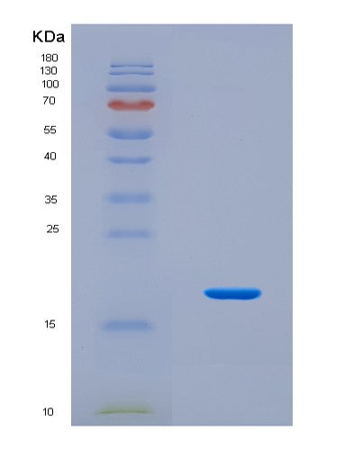 SDS-PAGE analysis of Human COMP (Cartilage Oligomeric Matrix Protein) - Recombinant Protein, CAT# BLT-08753P showing >90% purity under 15% SDS-PAGE (Reduced)