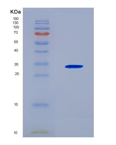 SDS-PAGE analysis of Human SOST (Sclerostin) - Recombinant Protein, CAT# BLT-08754P showing >90% purity under 15% SDS-PAGE (Reduced)