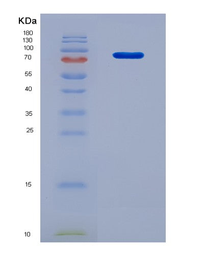 SDS-PAGE analysis of Mouse Serpina10 (Protein Z-Dependent Protease Inhibitor) - Recombinant Protein, CAT# BLT-08755P showing >90% purity under 15% SDS-PAGE (Reduced)