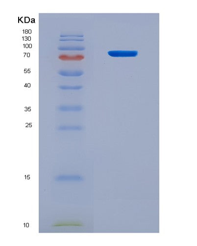 SDS-PAGE analysis of Human ACSL4 (Long-Chain-Fatty-Acid--Coa Ligase 4) - Recombinant Protein, CAT# BLT-08756P showing >90% purity under 15% SDS-PAGE (Reduced)