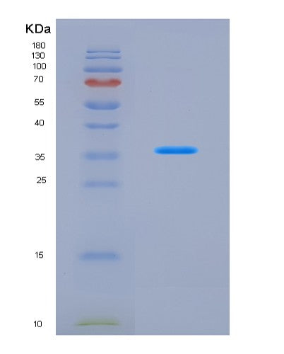 SDS-PAGE analysis of Human JAK2 (Tyrosine-Protein Kinase Jak2) - Recombinant Protein, CAT# BLT-08760P showing >90% purity under 15% SDS-PAGE (Reduced)