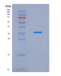 SDS-PAGE analysis of Human JAK2 (Tyrosine-Protein Kinase Jak2) - Recombinant Protein, CAT# BLT-08760P showing >90% purity under 15% SDS-PAGE (Reduced)