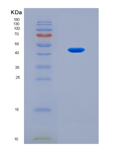 SDS-PAGE analysis of Mouse Bckdha (2-Oxoisovalerate Dehydrogenase Subunit Alpha, Mitochondrial) - Recombinant Protein, CAT# BLT-08757P showing >90% purity under 15% SDS-PAGE (Reduced)