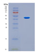 SDS-PAGE analysis of Mouse Bckdha (2-Oxoisovalerate Dehydrogenase Subunit Alpha, Mitochondrial) - Recombinant Protein, CAT# BLT-08757P showing >90% purity under 15% SDS-PAGE (Reduced)