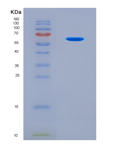 SDS-PAGE analysis of Mouse Ugp2 (Utp--Glucose-1-Phosphate Uridylyltransferase) - Recombinant Protein, CAT# BLT-08762P showing >90% purity under 15% SDS-PAGE (Reduced)