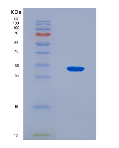 SDS-PAGE analysis of Mouse Tacstd2 (Tumor-Associated Calcium Signal Transducer 2) - Recombinant Protein, CAT# BLT-08763P showing >90% purity under 15% SDS-PAGE (Reduced)