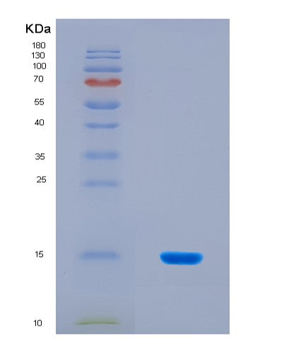 SDS-PAGE analysis of Mouse Serping1 (Plasma Protease C1 Inhibitor) - Recombinant Protein, CAT# BLT-08764P showing >90% purity under 15% SDS-PAGE (Reduced)