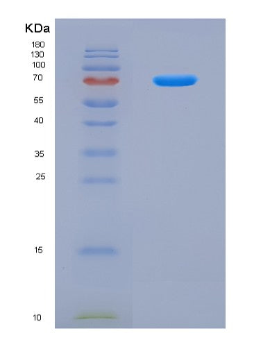 SDS-PAGE analysis of Human OAS1 (2'-5'-Oligoadenylate Synthase 1) - Recombinant Protein, CAT# BLT-08765P showing >90% purity under 15% SDS-PAGE (Reduced)