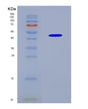 SDS-PAGE analysis of Human KCTD9 (Btb/Poz Domain-Containing Protein Kctd9) - Recombinant Protein, CAT# BLT-08766P showing >90% purity under 15% SDS-PAGE (Reduced)