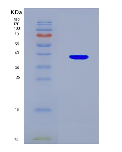 SDS-PAGE analysis of Human FAM76A (Protein Fam76A) - Recombinant Protein, CAT# BLT-08767P showing >90% purity under 15% SDS-PAGE (Reduced)