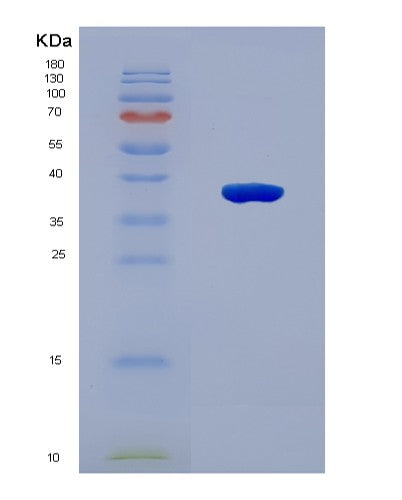SDS-PAGE analysis of Human ITPR3 (Inositol 1,4,5-Trisphosphate-Gated Calcium Channel Itpr3) - Recombinant Protein, CAT# BLT-08768P showing >90% purity under 15% SDS-PAGE (Reduced)