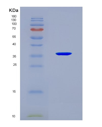 SDS-PAGE analysis of Human SUCLG1 (Succinate--Coa Ligase [Adp/Gdp-Forming] Subunit Alpha, Mitochondrial) - Recombinant Protein, CAT# BLT-08769P showing >90% purity under 15% SDS-PAGE (Reduced)