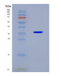 SDS-PAGE analysis of Human SUCLG1 (Succinate--Coa Ligase [Adp/Gdp-Forming] Subunit Alpha, Mitochondrial) - Recombinant Protein, CAT# BLT-08769P showing >90% purity under 15% SDS-PAGE (Reduced)