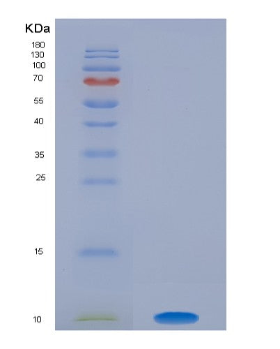 SDS-PAGE analysis of Human S100A1 (Protein S100-A1) - Recombinant Protein, CAT# BLT-08453P showing >90% purity under 15% SDS-PAGE (Reduced)